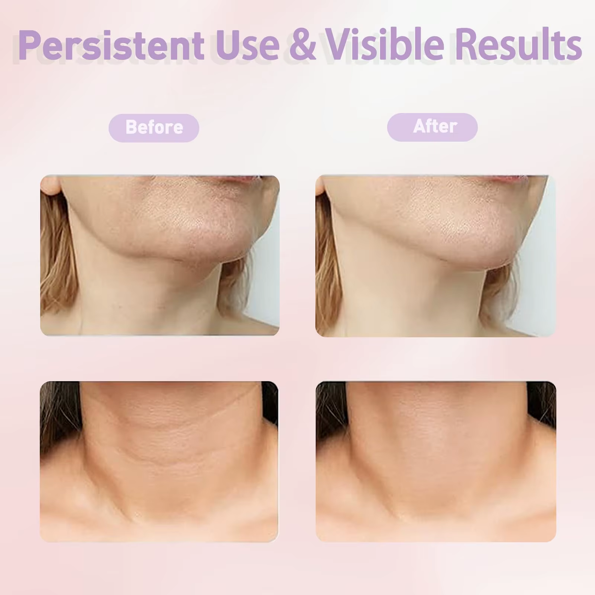 EMS Neck Face Lifter Neck Face Lifting Massager Skin Tighten Device Led Photon Therapy anti Wrinkle Double Chin Remover