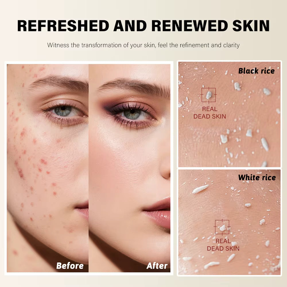 Reveal Smoother, Brighter Skin — Without Harsh Scrubs