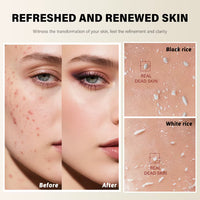 Reveal Smoother, Brighter Skin — Without Harsh Scrubs
