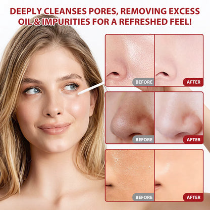 Reveal Smoother, Brighter Skin — Without Harsh Scrubs