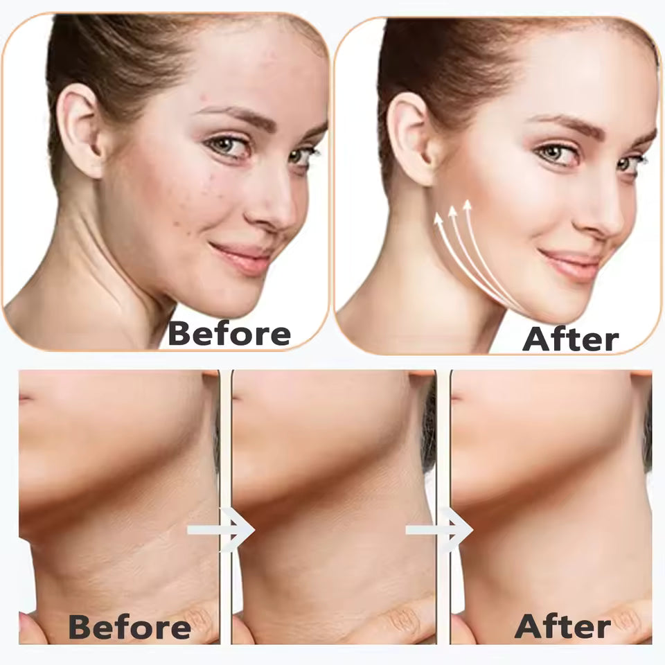 Aura Radiant Glow EMS Neck & Face Beauty Device – LED Skincare Tool